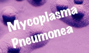 Polmoniti nei bambini, 2 casi da mycoplasma in Italia