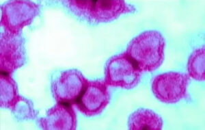Cosa sono i norovirus, responsabili della gastroenterite acuta non batterica